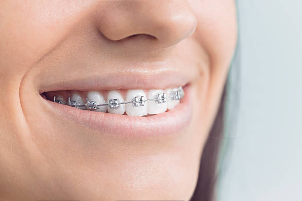 Best Veneers and Lumineers  in Prairie Village, KS